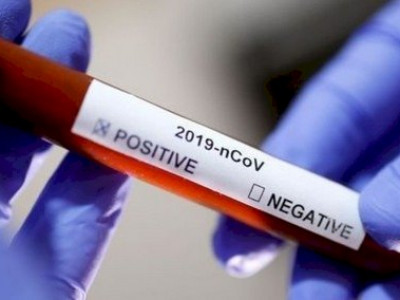 Números de casos e mortes por Covid caiu 50% no Estado