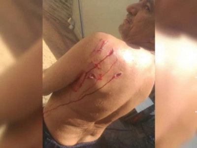 Capivara ataca banhista e o deixa ferido em cena inusitada