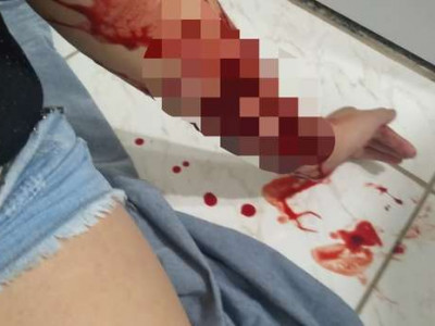 PMs salvam mulher que tentava se matar no Caiobá II