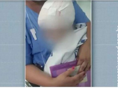 Menina de 2 anos é atacada por Pitbull no interior de SP