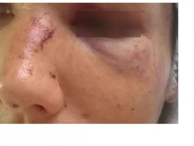 Mulher pede para sogra ficar com filhos e apanha no Tiradentes
