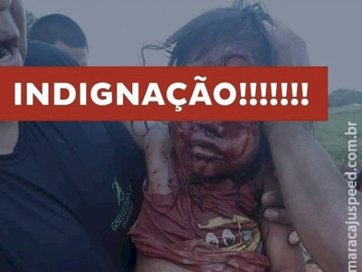Criança fica em estado grave após ser atacada por cão 
