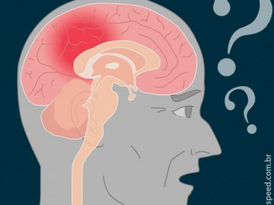 Vacina contra Alzheimer começa a ser testada em humanos