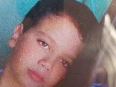 Criança de 10 anos morre durante extração de dente em clínica