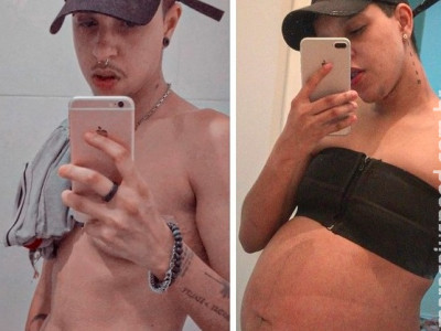 Homem trans dá à luz a um bebê em São Paulo