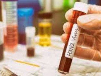 Idosa de Corumbá é 2ª morte pelo vírus H3N2 da gripe 