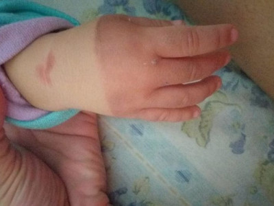 Mãe denuncia maus-tratos de babás contra bebê de um ano
