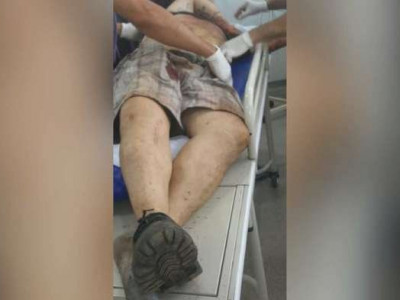 Troca de tiros deixa dois assaltantes de carreta mortos em MS