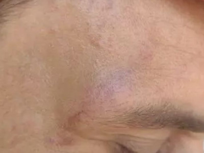 Vereador e médico saem na porrada após falta de aperto de mão 
