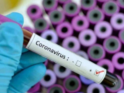 Brasil registra 74 mortes por covid-19 nas últimas 24 horas