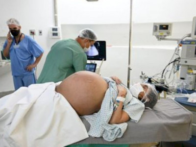 Mulher dá à luz quíntuplos na Zona Norte de São Paulo 