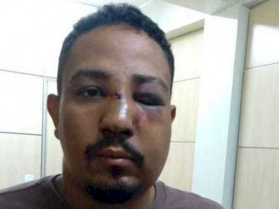 Homem agride cartomante por não concordar com previsão de tarô