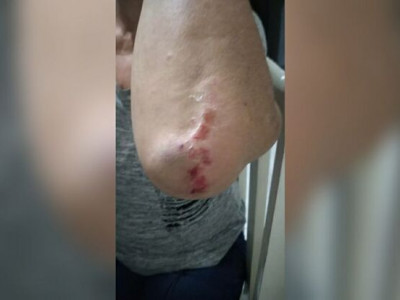 Bandido arrasta vítima pelos cabelos durante assalto
