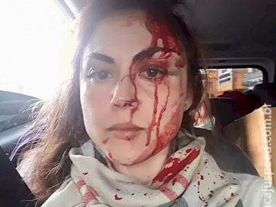 Procuradora espancada em SP revela que 