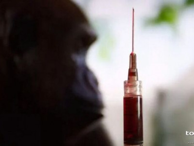 OMS faz alerta sobre avanço da varíola dos macacos no Brasil