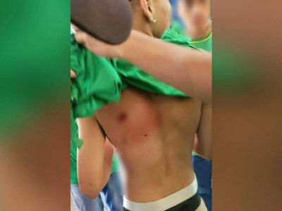 Aluno é esfaqueado em escola de Ponta Porã