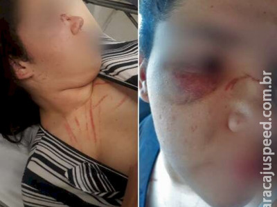 Briga deixa bebê ferido e adolescente com nariz quebrado