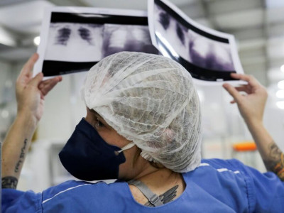 Casos de tuberculose aumentam 27,3% em Mato Grosso do Sul