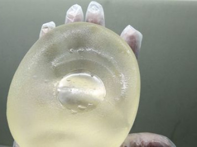 Lei garante troca de implante mamário para paciente de câncer