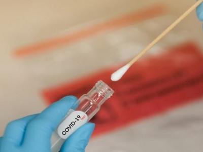 MS registra 536 novos casos e três mortes por Covid-19 