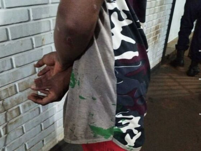 Jovens são esfaqueados no rosto após 