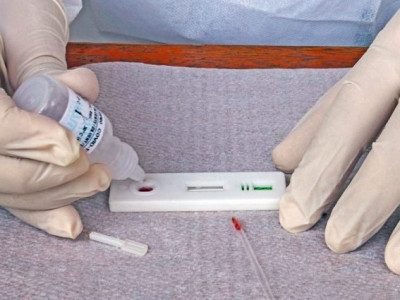 MS registra 330 novos casos de covid em sete dias