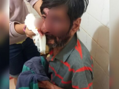 Em surto psicótico, homem desfigura rosto do pai com arma branca