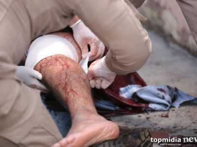 Mulher briga e mete facada no marido em Dourados