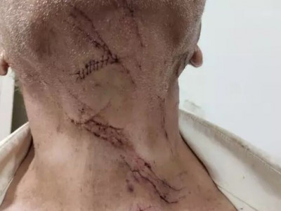 Adolescente esfaqueia avô de namorada para "dar lição" no idoso