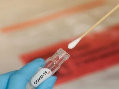 Com mais de 600 novos casos, Covid faz três vítimas em MS