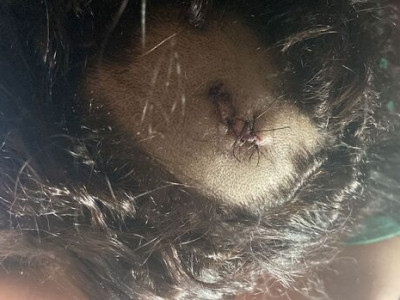 Mulher baleada pelo ex mostra pontos na cabeça após cirurgia