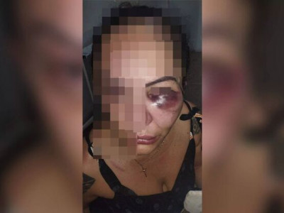 Homem agride, enforca e desfigura rosto de mulher no DF