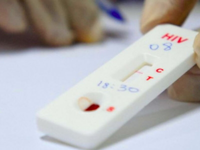 Em Campo Grande há 6,2 mil Pessoas Vivendo com HIV/Aids