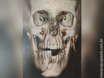 Suspeito de agredir esposa tem rosto deformado por justiceiros