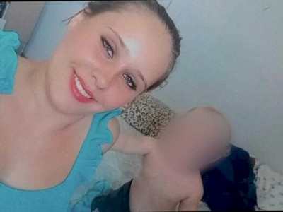 Mulher queimada contrai bactéria e estado é grave, diz família