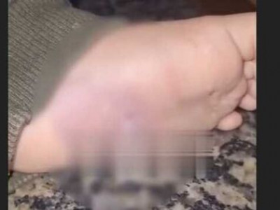 Bebê de 1 ano é espancado e queimado pelos pais no Amazonas