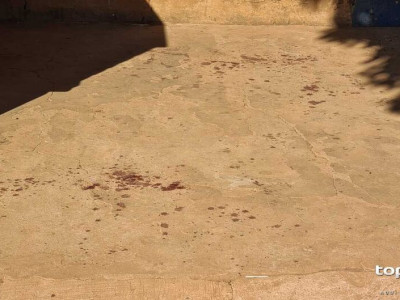 Mãe é baleada pelas costas em frente à filha no Lageado