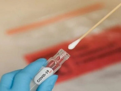 Covid registra novos casos e faz mais uma vítima no Estado