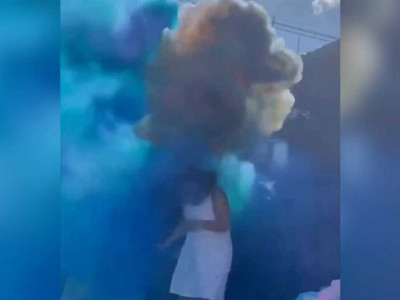 Pai tem queimaduras com fumaça de chá revelação