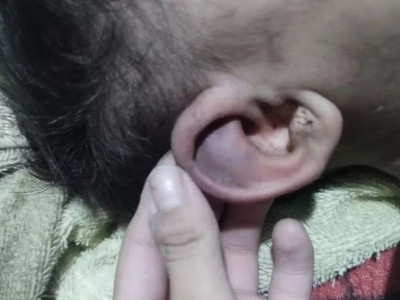 Polícia investiga se bebê de 1 ano sofreu tortura
