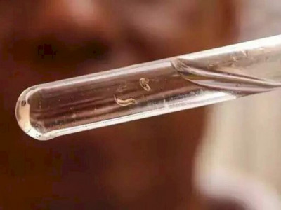  MS bate 15 mil casos confirmados de dengue em semana sem mortes