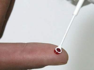 Saúde amplia vacinação contra o HPV para usuários de PrEP