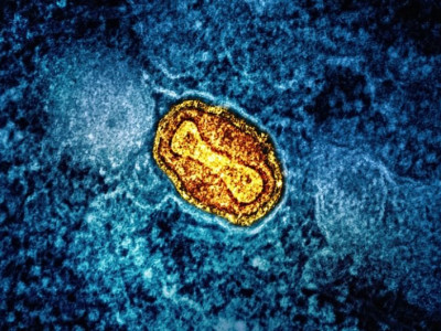 Mpox: OMS pede resposta após registro de nova variante na Suécia