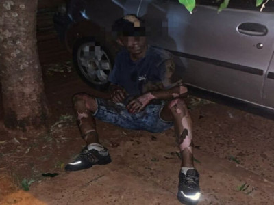 Homem sofre queimaduras enquanto furtava fios em Dourados