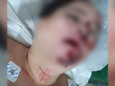 Mulher é espancada por três homens após festa em Ponta Porã