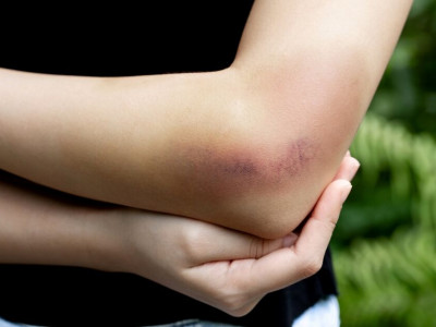 Mulher é agredida com cadeira pelo marido em Dourados