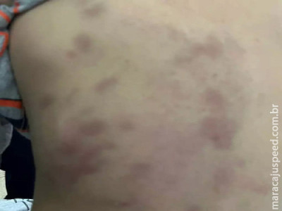 Homem é preso por espancar enteado de 3 anos em Dourados