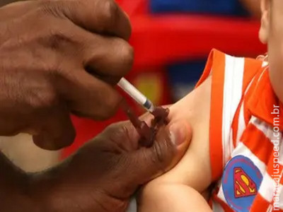 Casos de meningite ultrapassam 3 mil em São Paulo em 2025