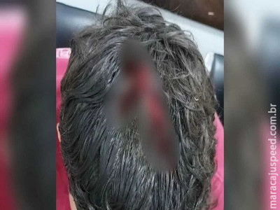 Jovem é baleado cinco vezes e fica em estado grave em Sonora