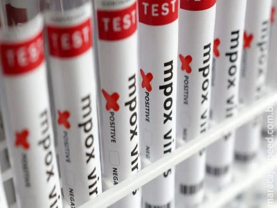 Mpox avança e acende alerta após 88 casos confirmados em 2026